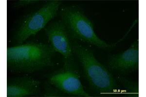 Immunofluorescence of monoclonal antibody to SNAI1 on U-2 OS cell. (SNAIL anticorps  (AA 121-230))