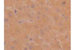 Detection of TPS in Human Liver Tissue using Polyclonal Antibody to Tryptase (TPS)