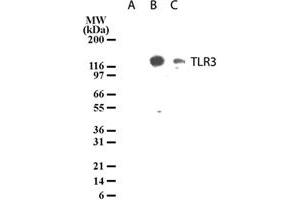 Western blot analysis of TLR3 in lysates from untransfected 293 cells (lane A), 293 cells transfected with human TLR3 cDNA (lane B), and 20 ug/lane human intestine tissue lysate (lane C).