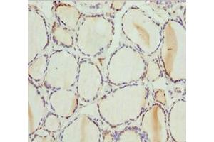 Immunohistochemistry of paraffin-embedded human thyroid tissue using ABIN7163421 at dilution of 1:100