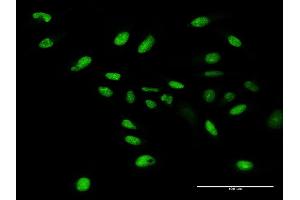 Immunofluorescence of purified MaxPab antibody to WDR4 on HeLa cell. (WDR4 anticorps  (AA 1-412))