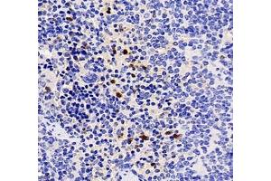 Immunohistochemistry of paraffin embedded mouse spleen using CXCR1 (ABIN7073465) at dilution of 1: 2000 (400x lens)