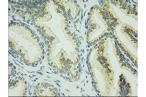 Immunohistochemical staining of paraffin-embedded Human prostate tissue using anti-C17orf28 mouse monoclonal antibody. (HID1/DMC1 anticorps)