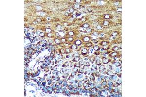 Immunohistochemistry of paraffin-embedded Human esophageal using SPECC1L Rabbit pAb (ABIN7270521) at dilution of 1:100 (40x lens). (SPECC1L anticorps  (AA 200-500))