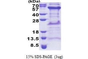 SDS-PAGE (SDS) image for TIMELESS Interacting Protein (TIPIN) (AA 1-301) protein (His tag) (ABIN5853259)
