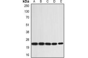 Western blot analysis of IL-36A expression in SW480 (A), A431 (B), mouse skin (C), mouse heart (D), rat liver (E) whole cell lysates. (IL36A/IL1F6 anticorps)