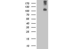 Western Blotting (WB) image for anti-Leucine-Rich Repeat Containing G Protein-Coupled Receptor 4 (LGR4) (AA 230-540) antibody (ABIN1491240) (LGR4 anticorps  (AA 230-540))