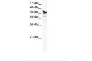 Image no. 1 for anti-DEAD (Asp-Glu-Ala-Asp) Box Polypeptide 41 (DDX41) (AA 447-496) antibody (ABIN202831) (DDX41 anticorps  (AA 447-496))