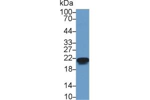 Detection of CBX3 in Human A375 cell lysate using Polyclonal Antibody to Chromobox Homolog 3 (CBX3) (CBX3 anticorps  (AA 1-183))