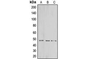 Western blot analysis of CNPase expression in HeLa (A), mouse brain (B), rat brain (C) whole cell lysates. (Cnpase anticorps  (Center))