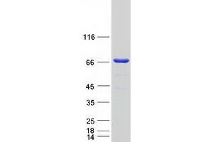 Validation with Western Blot