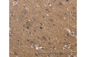 Immunohistochemistry of Human brain  using REL Polyclonal Antibody at dilution of 1:50 (c-Rel anticorps)