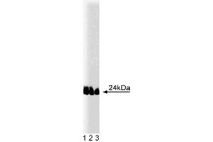 Western blot analysis of caveolin-1 (pY14) on lysates from A431 cells (Human epithelial carcinoma, ATCC CRL-1555) treated with 100 ng/mL EGF. (Caveolin anticorps  (pTyr14))