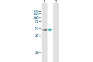 Western Blot analysis of CYLC2 expression in transfected 293T cell line by CYLC2 MaxPab polyclonal antibody.
