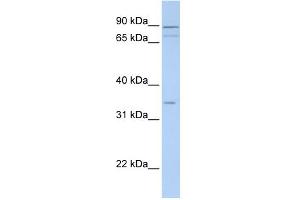 WB Suggested Anti-TNMD Antibody Titration:  0. (TNMD anticorps  (Middle Region))