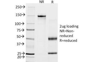 SDS-PAGE Analysis Purified Calponin-1 Mouse Monoclonal Antibody (CALP).