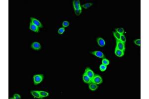 Immunofluorescent analysis of HepG2 cells using ABIN7154928 at dilution of 1:100 and Alexa Fluor 488-congugated AffiniPure Goat Anti-Rabbit IgG(H+L)