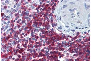 Human Spleen: Formalin-Fixed, Paraffin-Embedded (FFPE)