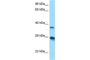 Host:  Rabbit  Target Name:  VSIG4  Sample Tissue:  Human COLO205 Whole Cell  Antibody Dilution:  1ug/ml (VSIG4 anticorps  (N-Term))