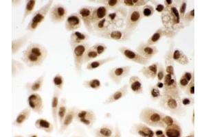 ICC testing of FFPE human PC-3 cells with DDB1 antibody. (DDB1 anticorps  (AA 1011-1140))