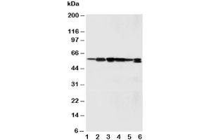 Western blot testing of SSH3BP1 antibody and Lane 1:  rat liver (ABI1 anticorps  (C-Term))
