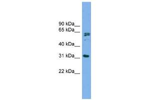 WB Suggested Anti-MITD1 Antibody Titration: 0.