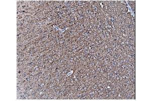 IHC analysis of Alpha Internexin/INA using anti-Alpha Internexin/INA antibody (ABIN7602187). (INA anticorps  (AA 62-169))
