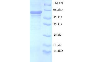 SDS-PAGE (SDS) image for O-Linked N-Acetylglucosamine (GlcNAc) Transferase (UDP-N-Acetylglucosamine:polypeptide-N-Acetylglucosaminyl Transferase) (OGT) (AA 606-1022), (partial) protein (His-SUMO Tag) (ABIN5710043)