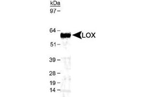 Western blot analysis of LOX in mouse kidney lysate using LOX polyclonal antibody  (1 : 1,000).