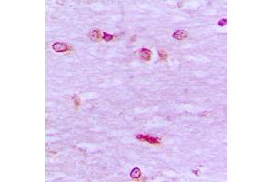 Immunohistochemical analysis of BRF1 staining in human brain formalin fixed paraffin embedded tissue section. (BRF1 anticorps  (Center))