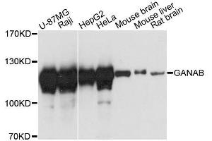 Western blot analysis of extracts of various cell lines, using GANAB antibody. (GANAB anticorps  (AA 1-260))