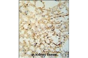 anti-Ly6/Plaur Domain Containing 1 (LYPD1) (AA 93-122), (C-Term) antibody