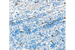 IHC analysis of CD68 using anti-CD68 antibody (ABIN7600142). (CD68 anticorps  (AA 154-354))