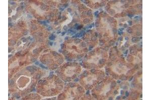 Detection of TGFbI in Mouse Kidney Tissue using Polyclonal Antibody to Transforming Growth Factor Beta Induced Protein (TGFbI)