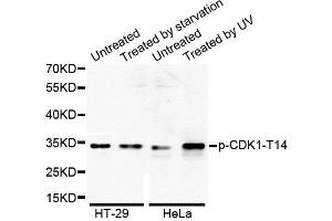 Western Blotting (WB) image for anti-Cyclin-Dependent Kinase 1 (CDK1) (pThr14) antibody (ABIN1870047) (CDK1 anticorps  (pThr14))