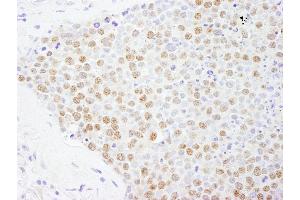 Immunohistochemistry (IHC) image for anti-Forkhead Box K2 (FOXK2) (AA 635-660) antibody (ABIN7454778)