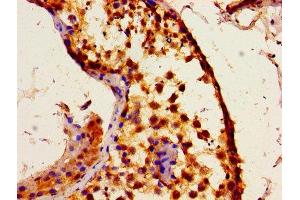 Immunohistochemistry of paraffin-embedded human testis tissue using ABIN7156293 at dilution of 1:100 (ITPR1 anticorps  (AA 1707-1966))