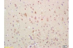 Formalin-fixed and paraffin embedded rat brain labeled with Anti-GADD45 Polyclonal Antibody, Unconjugated (ABIN685432) followed by conjugation to the secondary antibody and DAB staining (GADD45A anticorps  (AA 65-165))
