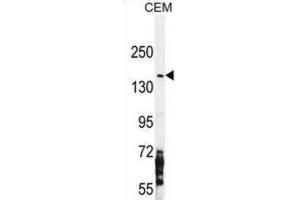 Western Blotting (WB) image for anti-Nitric Oxide Synthase 2, Inducible (NOS2) antibody (ABIN2996366) (NOS2 anticorps)