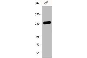 Western Blot analysis of 293 cells using DGK-ι Polyclonal Antibody (DGKI anticorps  (C-Term))