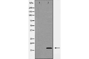 Western blot analysis of COX IV expression in Jurkat cells. (COX IV anticorps  (Internal Region))