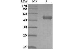 Western Blotting (WB) image for Poliovirus Receptor-Related Immunoglobulin Domain Containing (PVRIG) (Active) protein (mFc Tag) (ABIN7319903)