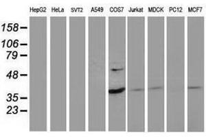 Image no. 2 for anti-PDZ and LIM Domain 2 (PDLIM2) antibody (ABIN1500128) (PDLIM2 anticorps)
