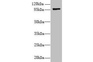 Western blot All lanes: FSCB antibody at 1. (FSCB anticorps  (AA 1-200))