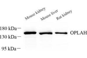 Western blot analysis of OPLAH (ABIN7072860) at dilution of 1: 500 (OPLAH anticorps)