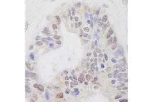 anti-Ring Finger Protein 40, E3 Ubiquitin Protein Ligase (RNF40) (AA 540-590) antibody