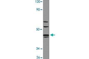 Western blot analysis of A-549 cell lysate with AGTR1 polyclonal antibody  at 1:500 dilution. (Angiotensin II Type-1 Receptor anticorps  (AA 150-200))