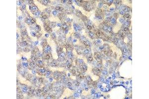 Immunohistochemistry of paraffin-embedded Rat liver using FAH Polyclonal Antibody at dilution of 1:100 (40x lens).