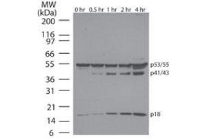 Caspase-8 Western Blot. (Caspase 8 anticorps)