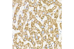 Immunohistochemistry of paraffin-embedded human liver using  Rabbit mAb (ABIN7265363) at dilution of 1:25 (40x lens). (ACAT1 anticorps)
